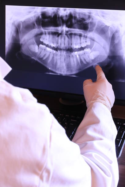 Best Emergency Treatment for Dental Infections or Abscesses in New Franklin, MO